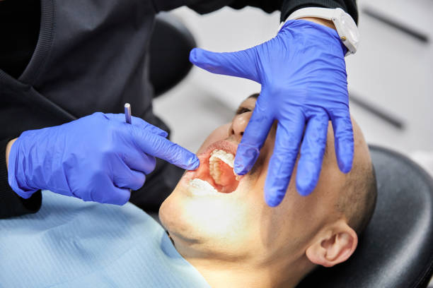 Best Emergency Tooth Extraction in Chickasha, OK